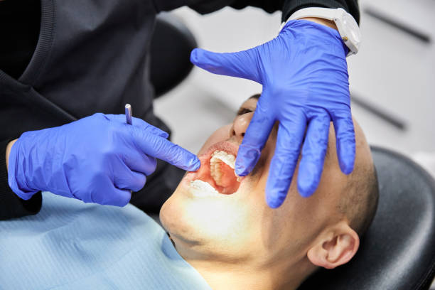 Best Dentist for Tooth Abscess  in Blacklick Estates, OH