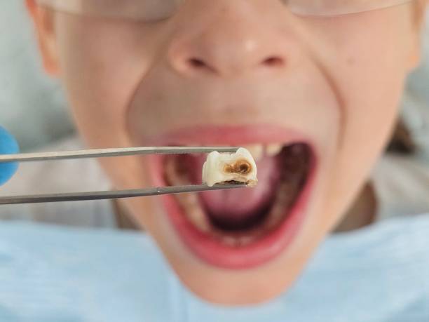Best Emergency Dentist for Kids  in Blacklick Estates, OH